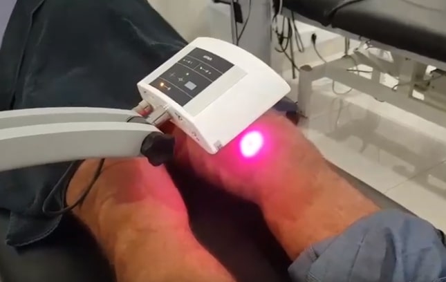 Kako izgleda terapija na našem skenirajućem laseru