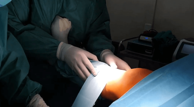 Šta je artroskopija? dr Miodrag Glišić - Analife