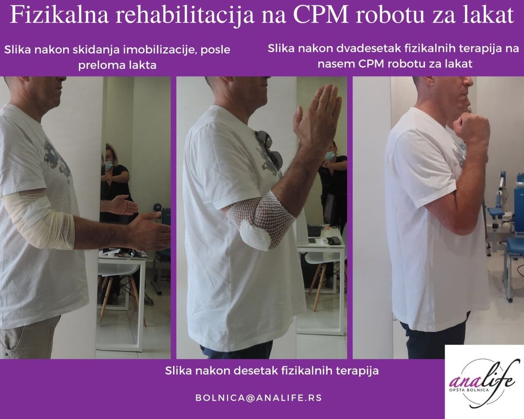 Terapija na CPM robotu za lakat