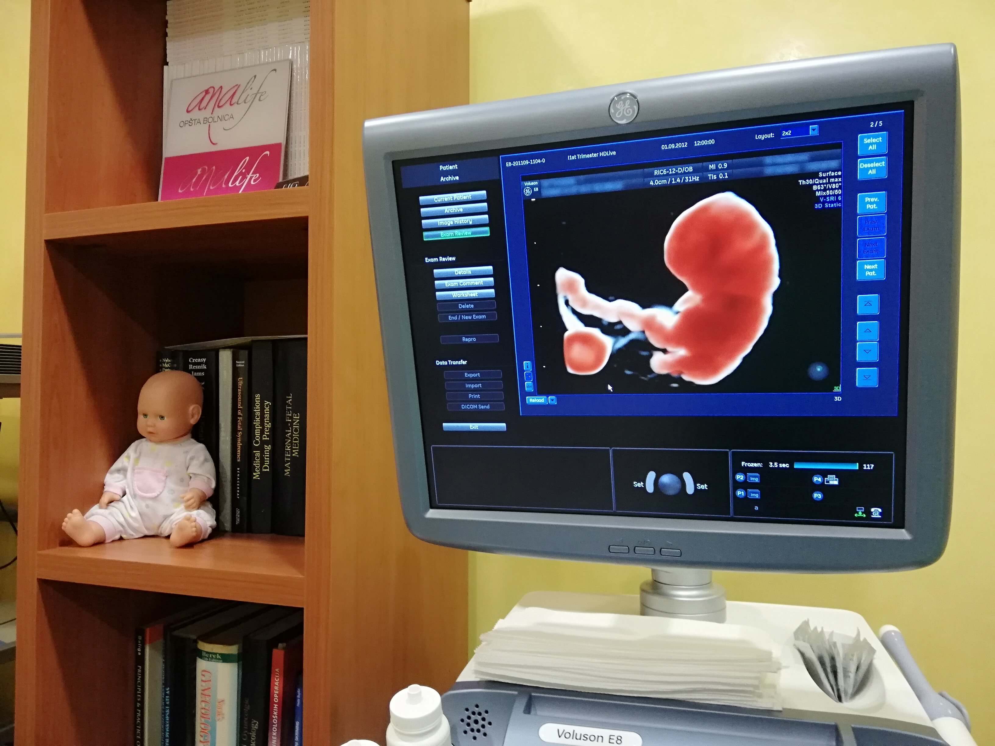 3D/4D Utvrdjivanje trudnoće - Dr Vojislav Živanić
