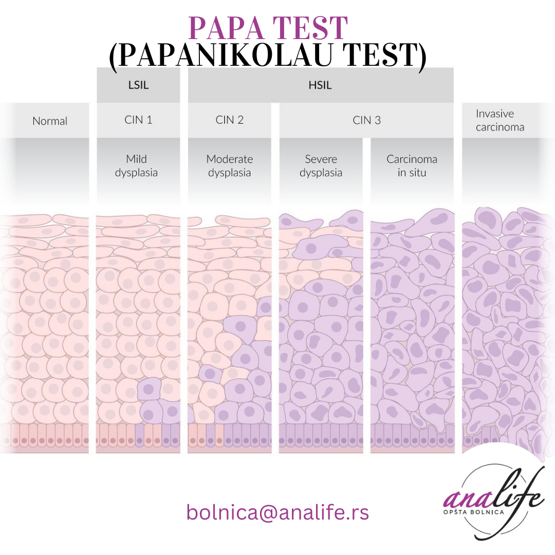 #Papa ili #Papanikolau test predstavlja skrining metodu koja se radi u cilju ranog otkrivanja karcinoma grlića materice. 