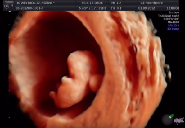 Kako izgleda beba u osmoj nedelji trudnoće - Utvrdjivanje trudnoće