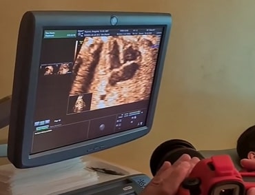 Evo kako izgleda fetalna ehokardiografija najvažniji deo Ekspertskog 3D/4D ultrazvučnog pregleda