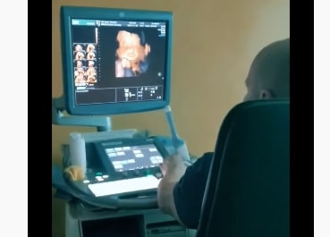 Ekspertski ultrazvučni pregled doktora Živanića