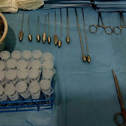 Plastic surgery face fat transplantation 