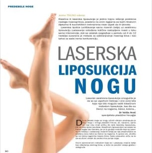 Plastična hirurgija laserska liposukcija nogu 2
