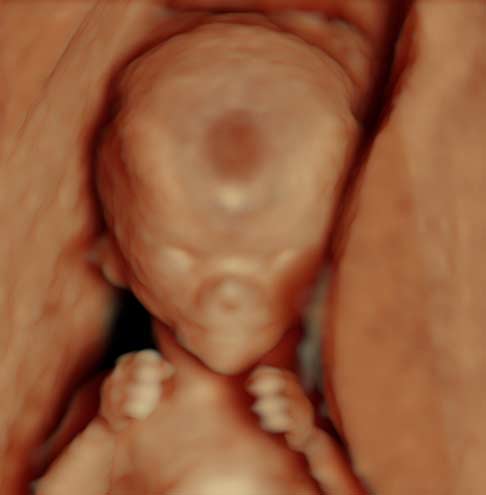 Trudnoća ekspertski 4D ultrazvuk od 11 13 nedelje trudnoće 