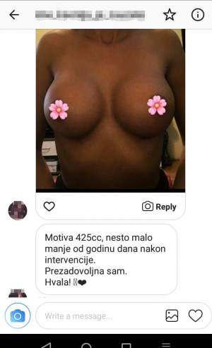 Povećanje grudi (augmentacija) – prirodan volumen i sklad proporcija - slika 27