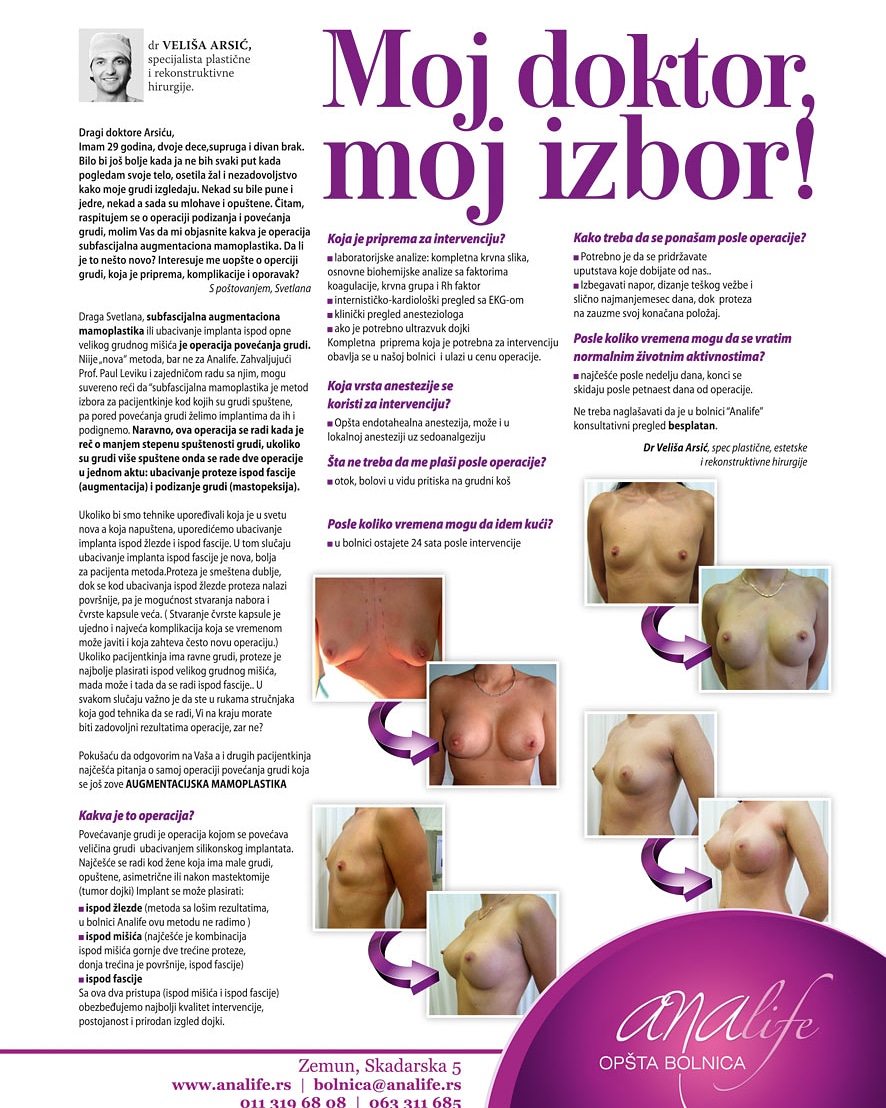 Povećanje grudi (augmentacija) – prirodan volumen i sklad proporcija - slika 44