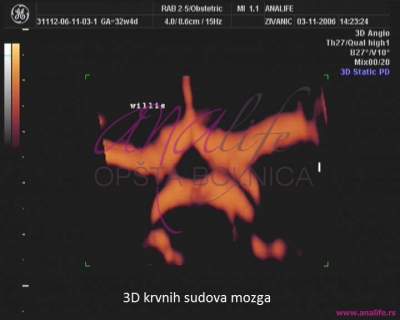 Ekspertski 4D ultrazvuk sa fetalnom ehokardiografijom u 20–24. nedelji trudnoće - slika 6
