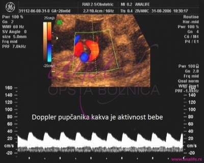 Ekspertski 4D ultrazvuk sa fetalnom ehokardiografijom u 20–24. nedelji trudnoće - slika 8