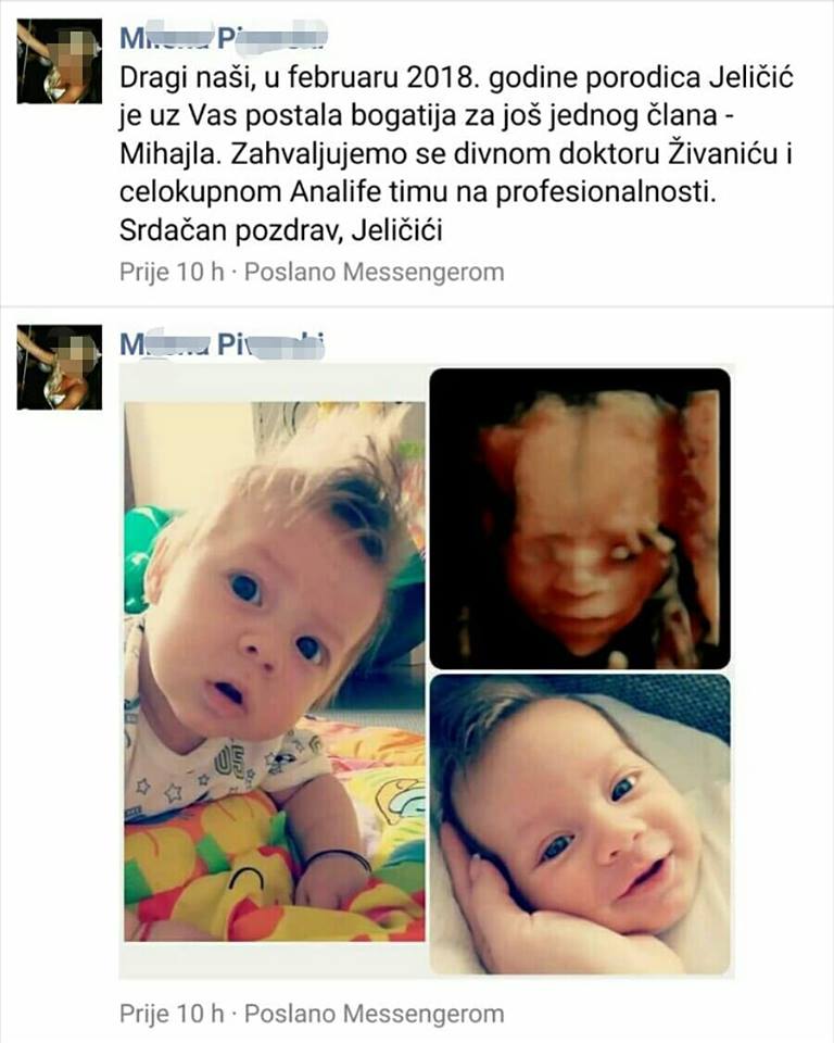 Ekspertski 4D ultrazvuk sa fetalnom ehokardiografijom u 20–24. nedelji trudnoće - slika 25