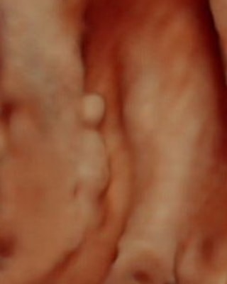 Ekspertski 4D ultrazvuk sa fetalnom ehokardiografijom u 20–24. nedelji trudnoće - slika 38