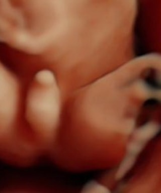 Ekspertski 4D ultrazvuk sa fetalnom ehokardiografijom u 20–24. nedelji trudnoće - slika 40