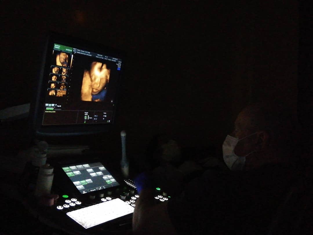 Ekspertski 4D ultrazvuk sa fetalnom ehokardiografijom u 20–24. nedelji trudnoće - slika 42