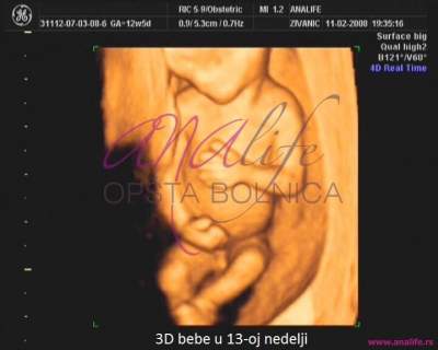 Ekspertski 4d Ultrazvuk Od 11 13 Nedelje Trudnoce Opsta Bolnica Analife