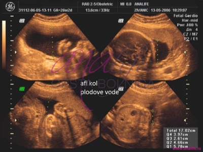 Ekspertski 4d Ultrazvuk Od 25 27 Nedelje Trudnoce Opsta Bolnica Analife