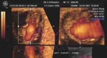 1537262667_trudnoća 4D 3D ultrazvučni pregled do 9 nedelje trudnoće galerija 3