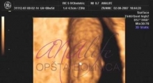1537262667_trudnoća 4D 3D ultrazvučni pregled do 9 nedelje trudnoće galerija 4