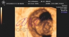 1537262667_trudnoća 4D 3D ultrazvučni pregled do 9 nedelje trudnoće galerija 5