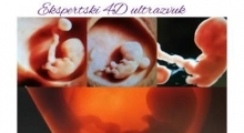 1537262668_trudnoća 4D 3D ultrazvučni pregled do 9 nedelje trudnoće galerija 6