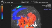 1537264992_trudnoća ekspertski 4D ultrazvuk od 11 13 nedelje trudnoće galerija 11