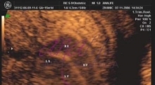 1537266083_trudnoca ekspertski 4D ultrazvuk od 14 19 nedelje trudnoce galerija 2