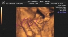 1537266083_trudnoca ekspertski 4D ultrazvuk od 14 19 nedelje trudnoce galerija 3