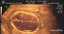 1537347726_trudnoća anomalije u trudnoći galerija 11