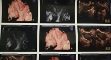 1538986984_ginekologija 3D ultrazvuk male karlice galerija 13