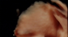 1543220775_07.ultrazvuk beba galerija