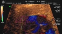 1543228334_02.trudnoća ekspertski 4D ultrazvuk od 20 24 nedelje trudnoće galerija