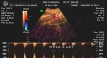 1543228335_05.trudnoća ekspertski 4D ultrazvuk od 20 24 nedelje trudnoće galerija