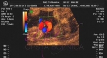 1543228339_09.trudnoća ekspertski 4D ultrazvuk od 20 24 nedelje trudnoće galerija