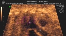 1543228340_10.trudnoća ekspertski 4D ultrazvuk od 20 24 nedelje trudnoće galerija