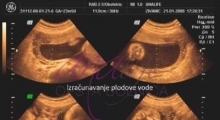 1543228769_09.trudnoća ekspertski 4D ultrazvuk od 25 27 nedelje trudnoće galerija