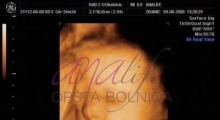 1543228770_10.trudnoća ekspertski 4D ultrazvuk od 25 27 nedelje trudnoće galerija