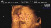 1543228771_14.trudnoća ekspertski 4D ultrazvuk od 25 27 nedelje trudnoće galerija