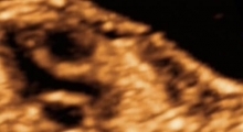 1547572557_15.trudnoca ekspertski 4D ultrazvuk od 20 24 nedelje trudnoce galerija