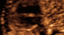 1547572558_17.trudnoca ekspertski 4D ultrazvuk od 20 24 nedelje trudnoce galerija