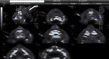 1553511079_19.trudnoca ekspertski 4D ultrazvuk od 20 24 nedelje trudnoce galerija