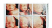 1554665368_trudnoća 4D 3D ultrazvučni pregled do 9 nedelje trudnoće galerija 7
