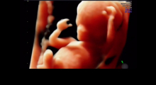 1554665569_trudnoća ekspertski 4D ultrazvuk od 11 13 nedelje trudnoće galerija 22