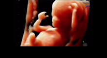 1554665570_trudnoća ekspertski 4D ultrazvuk od 11 13 nedelje trudnoće galerija 23
