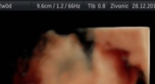 1554666225_35.trudnoca ekspertski 4D ultrazvuk od 20 24 nedelje trudnoce galerija
