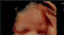 1554667065_27.trudnoca ekspertski 4D ultrazvuk od 25 27 nedelje trudnoce galerija