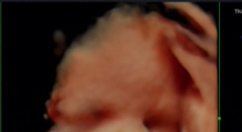 1554667065_28.trudnoca ekspertski 4D ultrazvuk od 25 27 nedelje trudnoce galerija