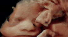 1554667065_30.trudnoca ekspertski 4D ultrazvuk od 25 27 nedelje trudnoce galerija