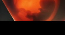 1556638421_trudnoća 4D 3D ultrazvučni pregled do 9 nedelje trudnoće galerija 8