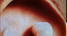 1556638422_trudnoća 4D 3D ultrazvučni pregled do 9 nedelje trudnoće galerija 10